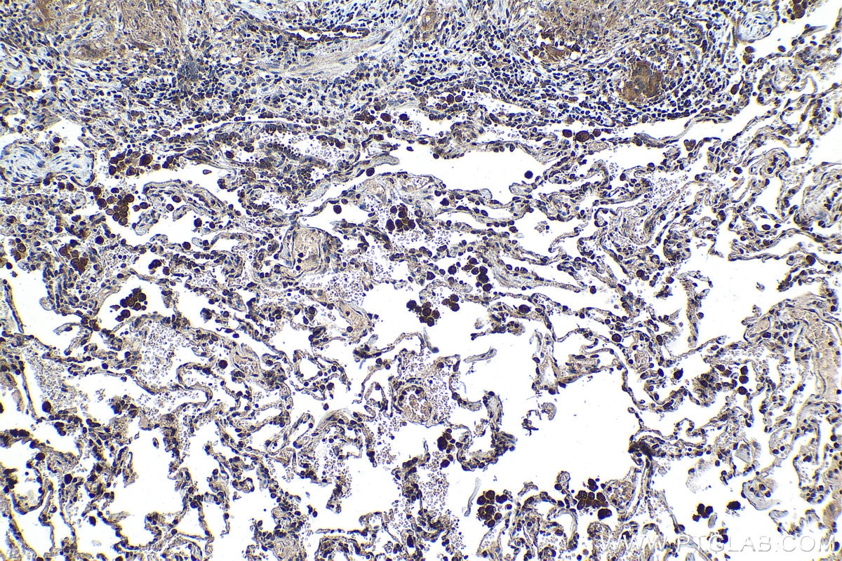 Immunohistochemical analysis of paraffin-embedded human lung tissue slide using KHC1450 (PHF1 IHC Kit).