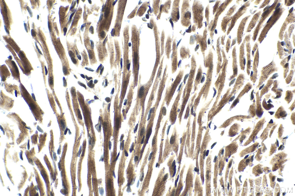 Immunohistochemical analysis of paraffin-embedded mouse heart tissue slide using KHC1450 (PHF1 IHC Kit).