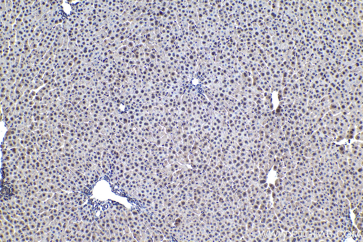 Immunohistochemical analysis of paraffin-embedded rat liver tissue slide using KHC1487 (PHF14 IHC Kit).
