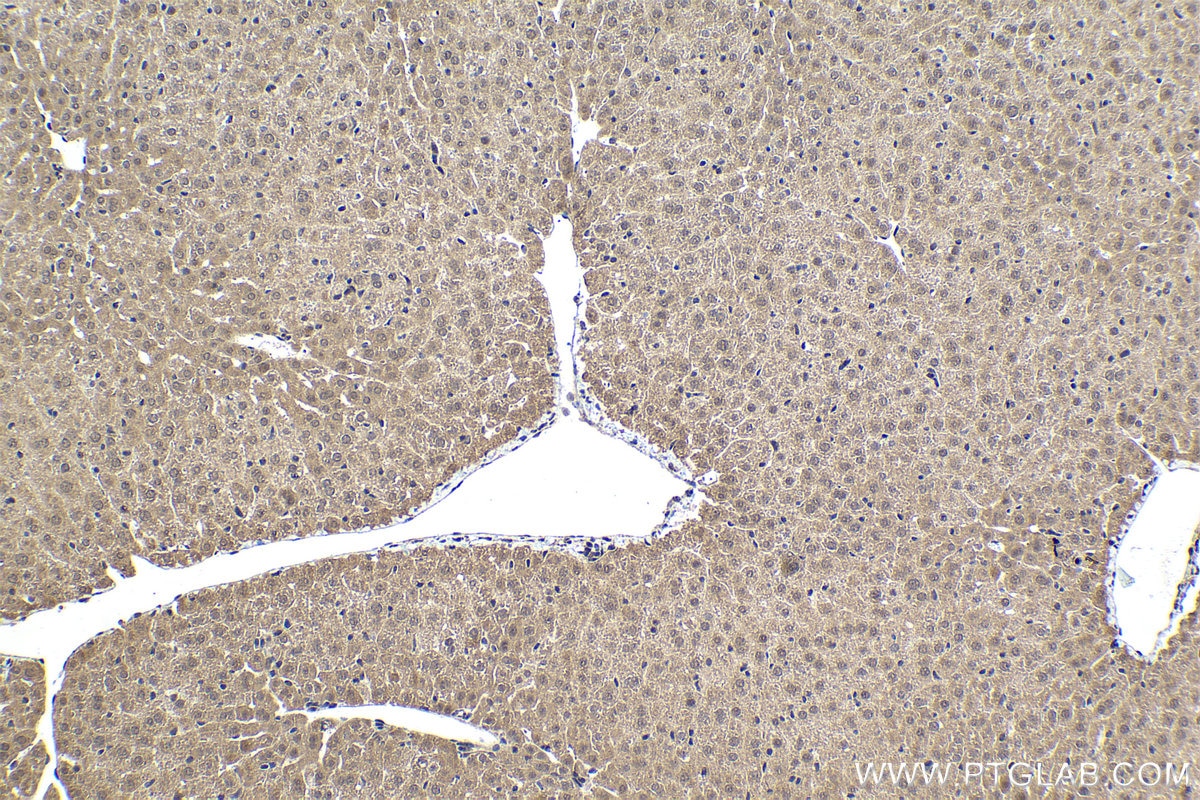 Immunohistochemical analysis of paraffin-embedded mouse liver tissue slide using KHC1487 (PHF14 IHC Kit).