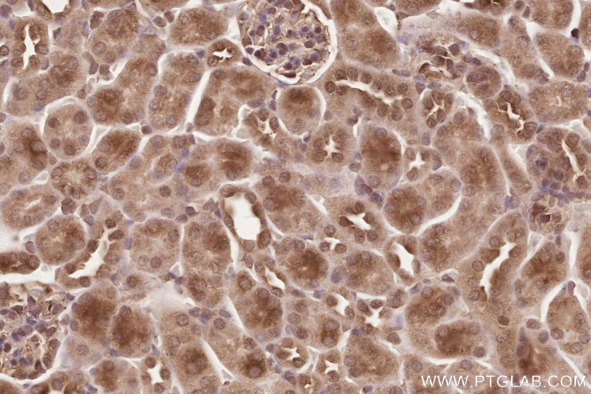 Immunohistochemical analysis of paraffin-embedded mouse kidney tissue slide using KHC2579 (PHF17 IHC Kit).