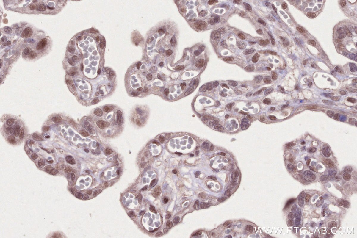 Immunohistochemical analysis of paraffin-embedded human placenta tissue slide using KHC2653 (PHF6 IHC Kit).