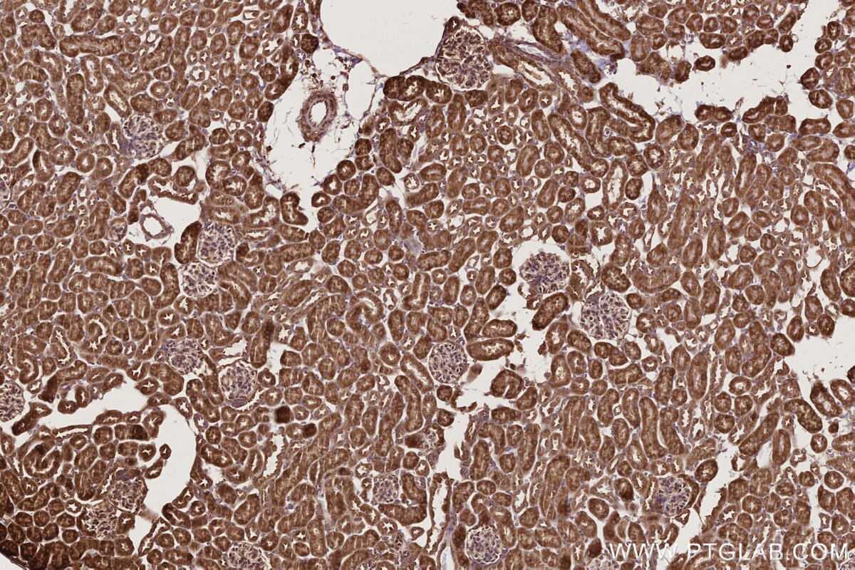 Immunohistochemical analysis of paraffin-embedded mouse kidney tissue slide using KHC2772 (PHKB IHC Kit).