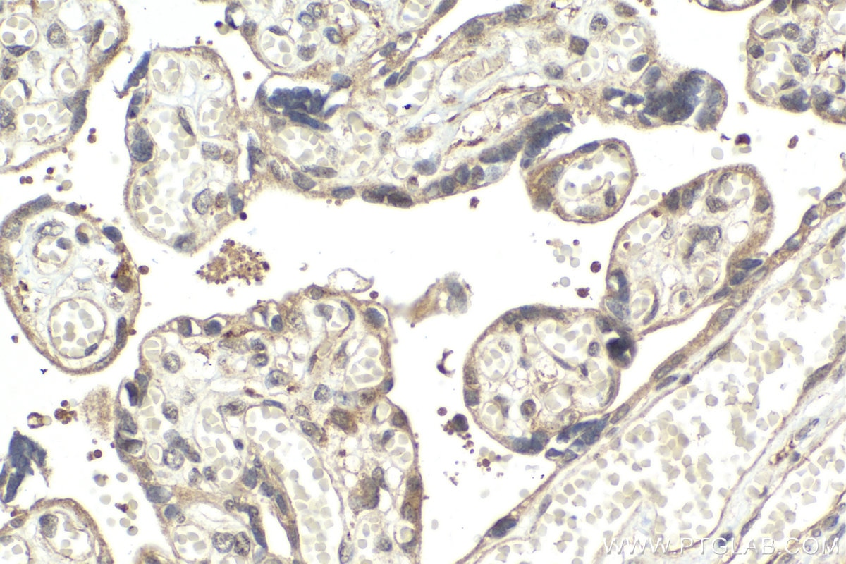 Immunohistochemical analysis of paraffin-embedded human placenta tissue slide using KHC2033 (PIAS3 IHC Kit).
