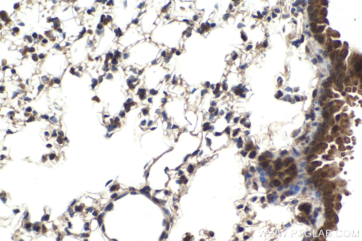 Immunohistochemical analysis of paraffin-embedded mouse lung tissue slide using KHC2033 (PIAS3 IHC Kit).