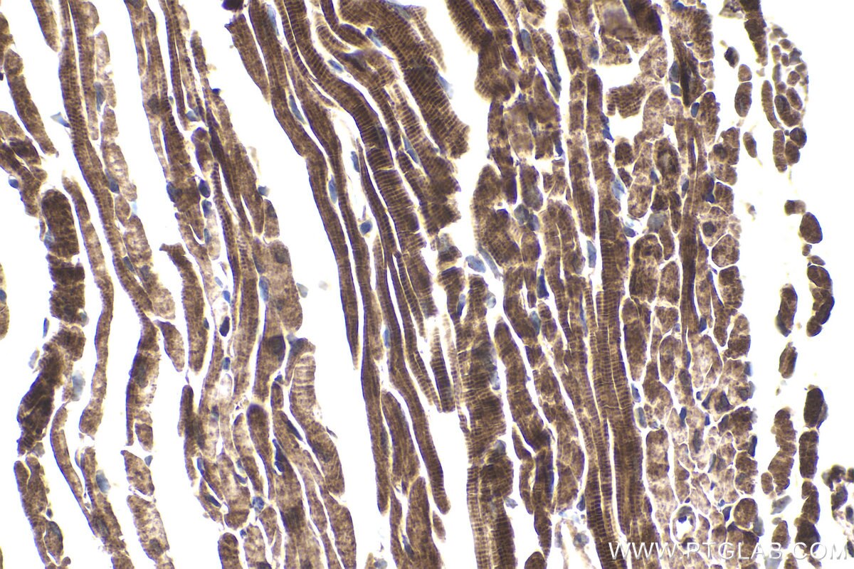 Immunohistochemical analysis of paraffin-embedded mouse heart tissue slide using KHC1943 (PIDD1 IHC Kit).