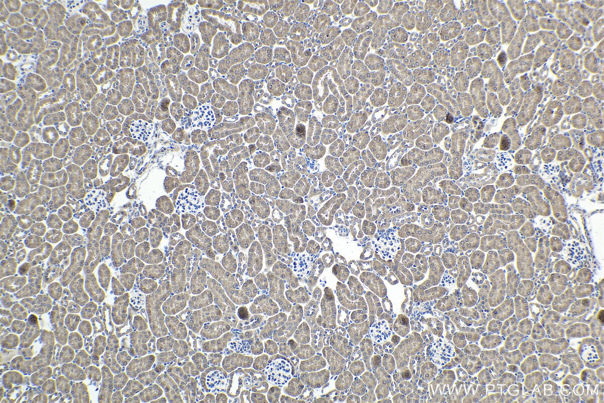 Immunohistochemical analysis of paraffin-embedded mouse kidney tissue slide using KHC1943 (PIDD1 IHC Kit).