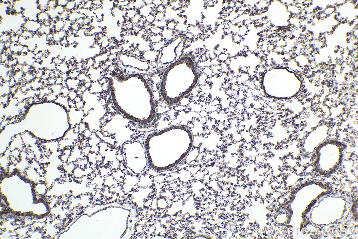 Immunohistochemical analysis of paraffin-embedded mouse lung tissue slide using KHC1943 (PIDD1 IHC Kit).