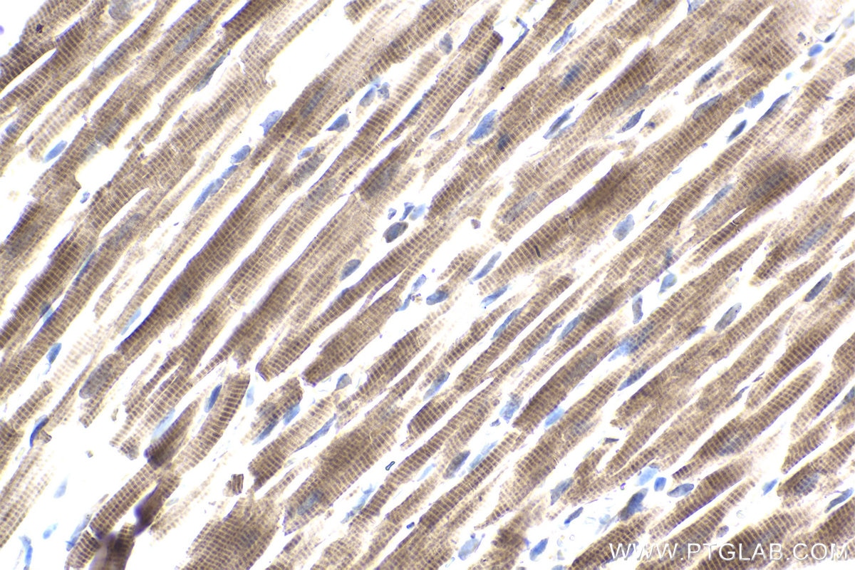 Immunohistochemical analysis of paraffin-embedded rat heart tissue slide using KHC1943 (PIDD1 IHC Kit).