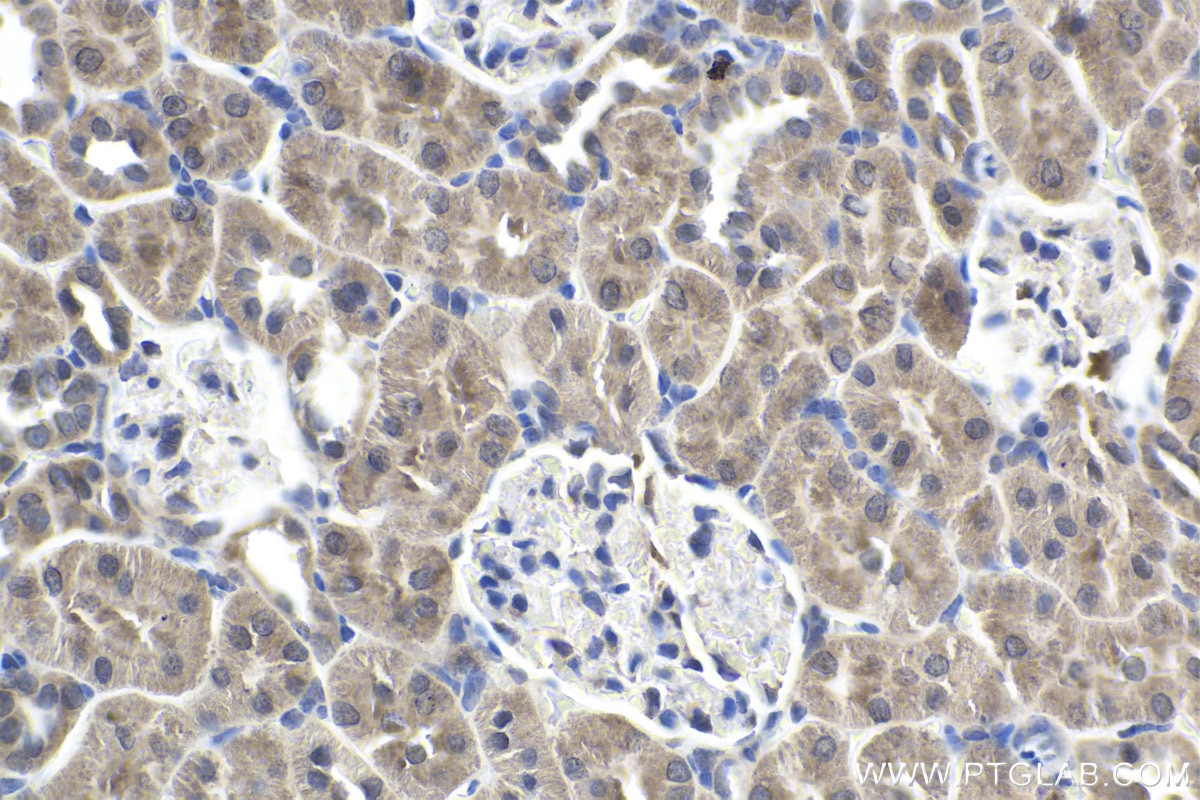 Immunohistochemical analysis of paraffin-embedded rat kidney tissue slide using KHC1943 (PIDD1 IHC Kit).