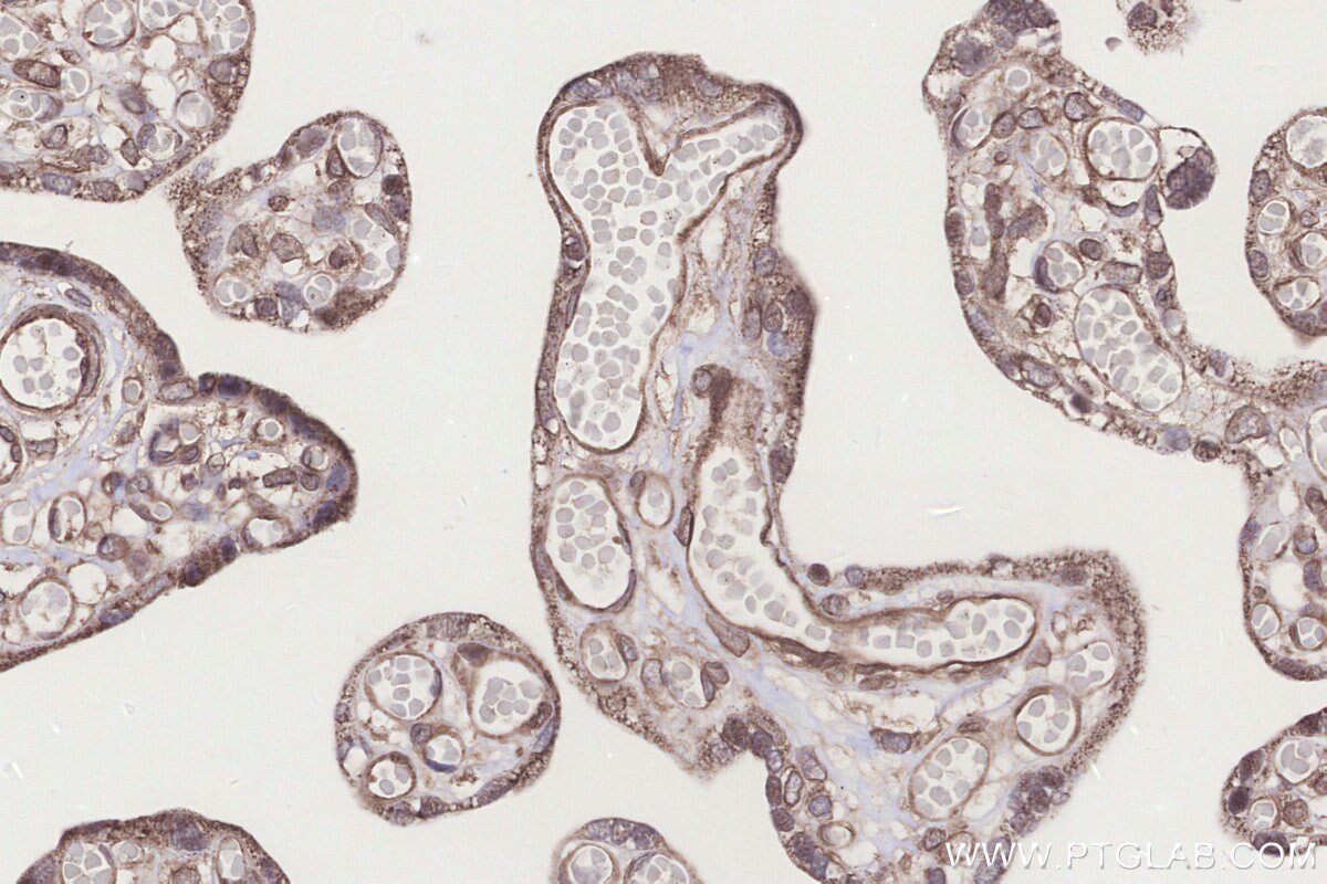 Immunohistochemical analysis of paraffin-embedded human placenta tissue slide using KHC3234 (PIGP IHC Kit). Immunohistochemical analysis of paraffin-embedded human placenta tissue slide using KHC3234 (PIGP IHC Kit).