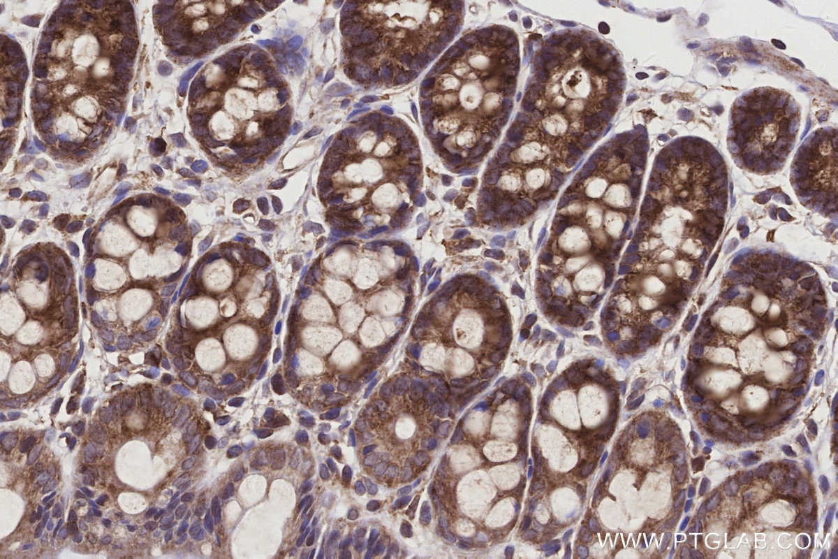 Immunohistochemical analysis of paraffin-embedded rat colon tissue slide using KHC3161 (PIGR IHC Kit).