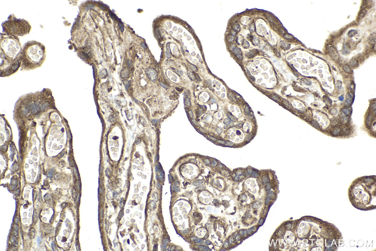 Immunohistochemical analysis of paraffin-embedded human placenta tissue slide using KHC2044 (PIK3C2A IHC Kit).