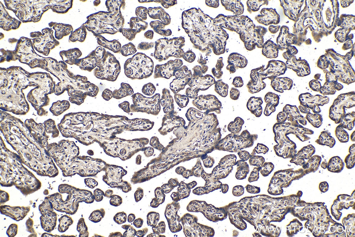 Immunohistochemical analysis of paraffin-embedded human placenta tissue slide using KHC1059 (PIK3CA IHC Kit).