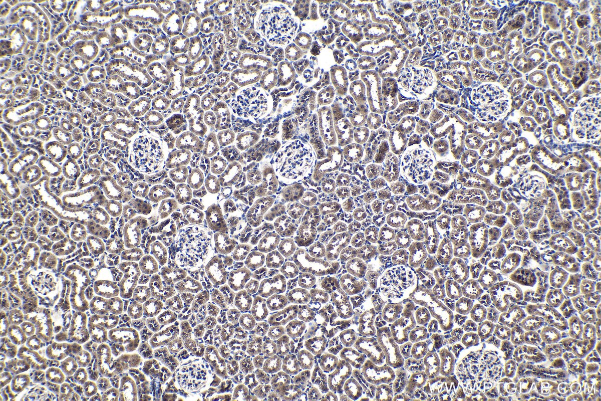 Immunohistochemical analysis of paraffin-embedded rat kidney tissue slide using KHC1059 (PIK3CA IHC Kit).