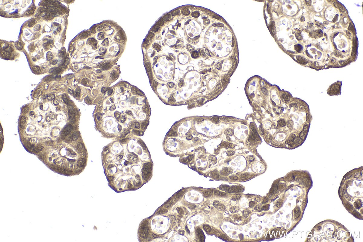 Immunohistochemical analysis of paraffin-embedded human placenta tissue slide using KHC2045 (PIK3R2 IHC Kit).