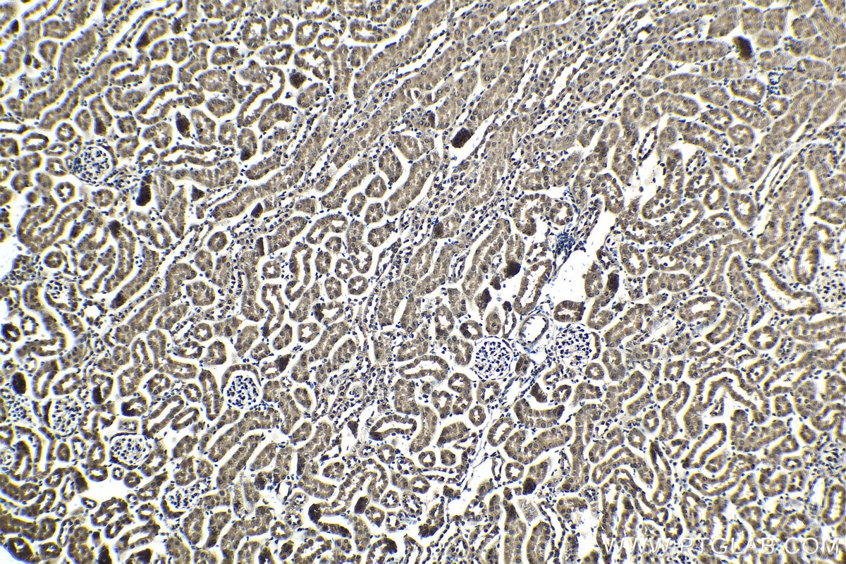 Immunohistochemical analysis of paraffin-embedded mouse kidney tissue slide using KHC2045 (PIK3R2 IHC Kit).