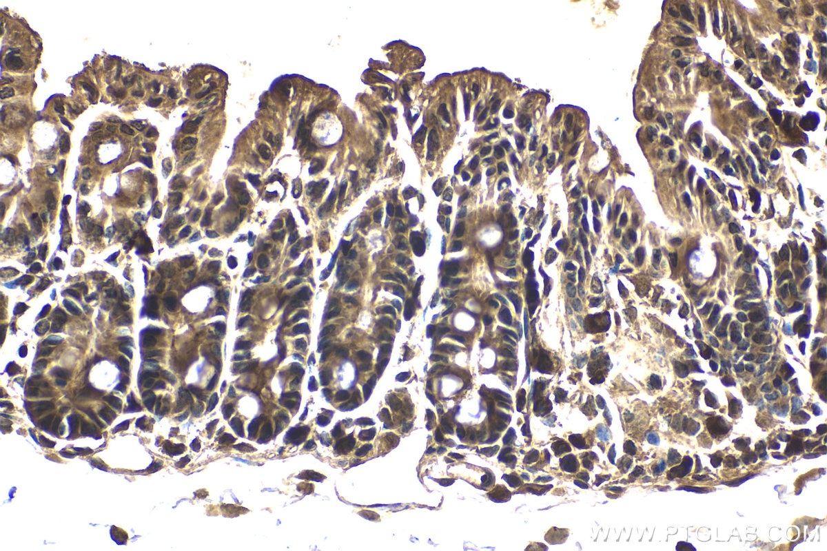 Immunohistochemical analysis of paraffin-embedded mouse small intestine tissue slide using KHC2045 (PIK3R2 IHC Kit).