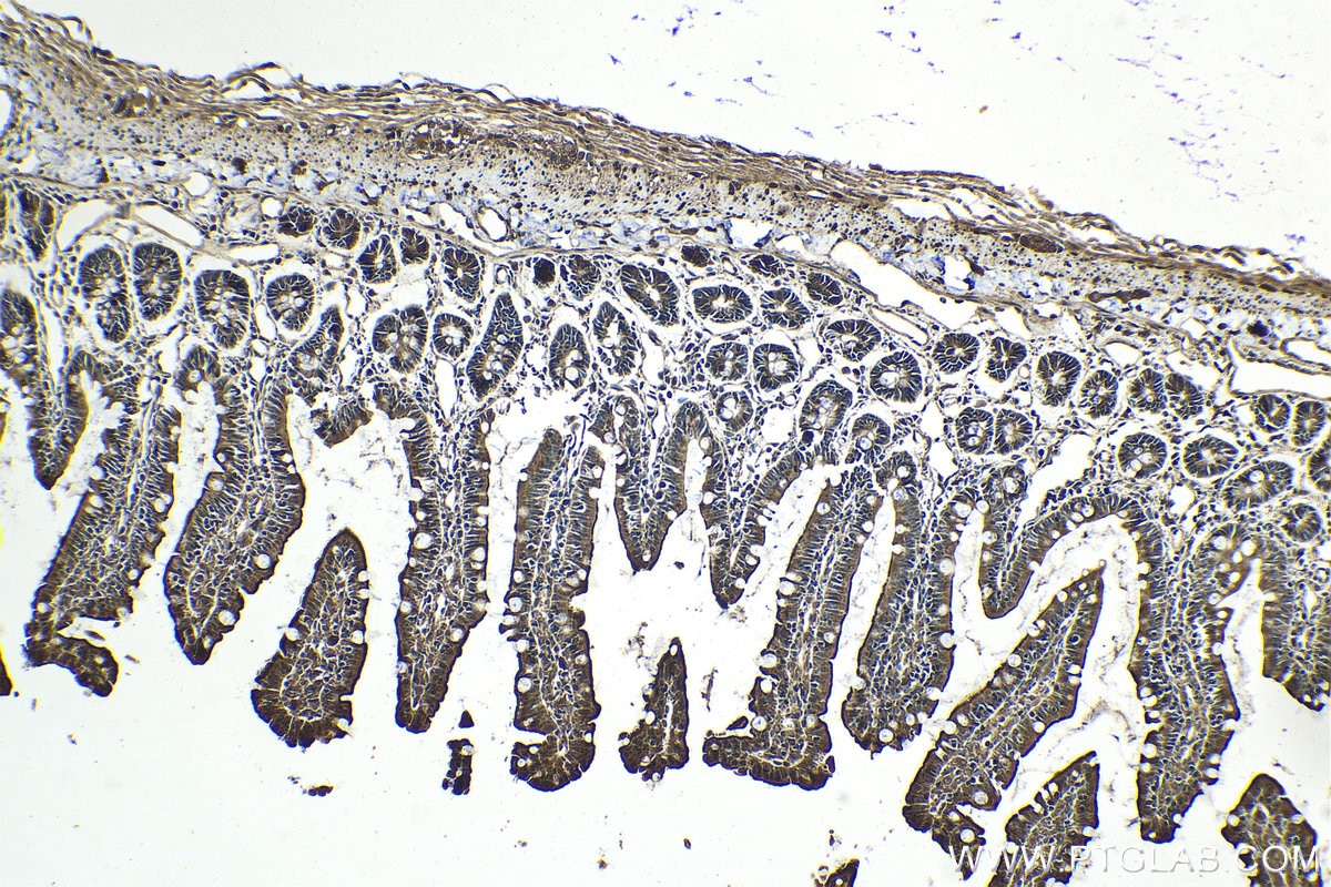 Immunohistochemical analysis of paraffin-embedded rat small intestine tissue slide using KHC2045 (PIK3R2 IHC Kit).