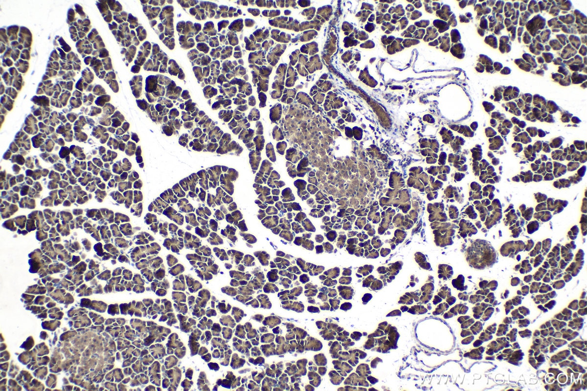 Immunohistochemical analysis of paraffin-embedded rat pancreas tissue slide using KHC1524 (PIM1 IHC Kit).