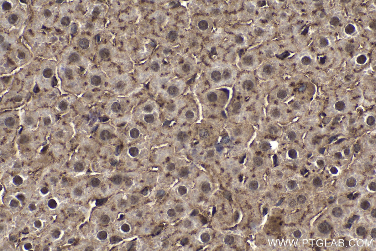 Immunohistochemical analysis of paraffin-embedded rat liver tissue slide using KHC1524 (PIM1 IHC Kit).