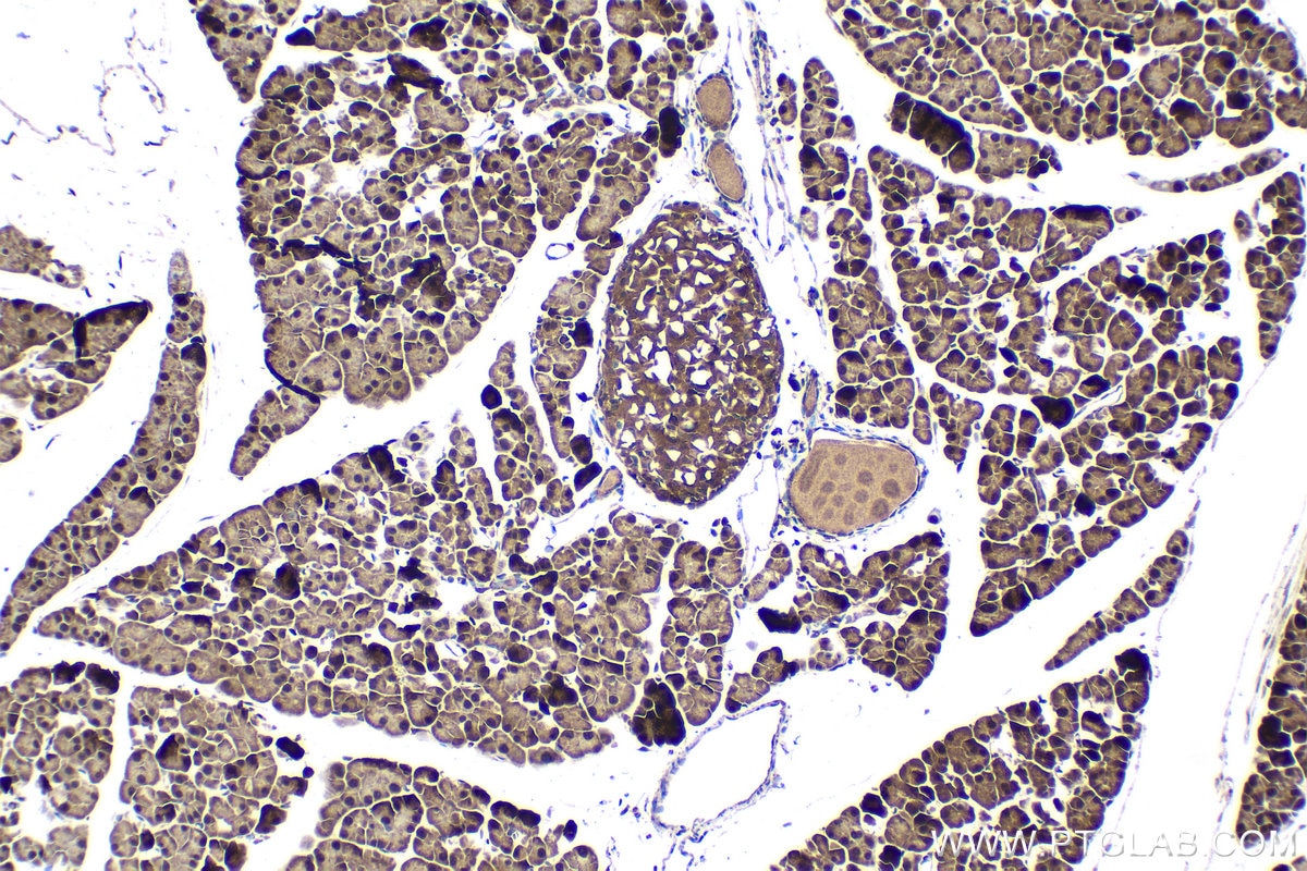 Immunohistochemical analysis of paraffin-embedded mouse pancreas tissue slide using KHC1524 (PIM1 IHC Kit).