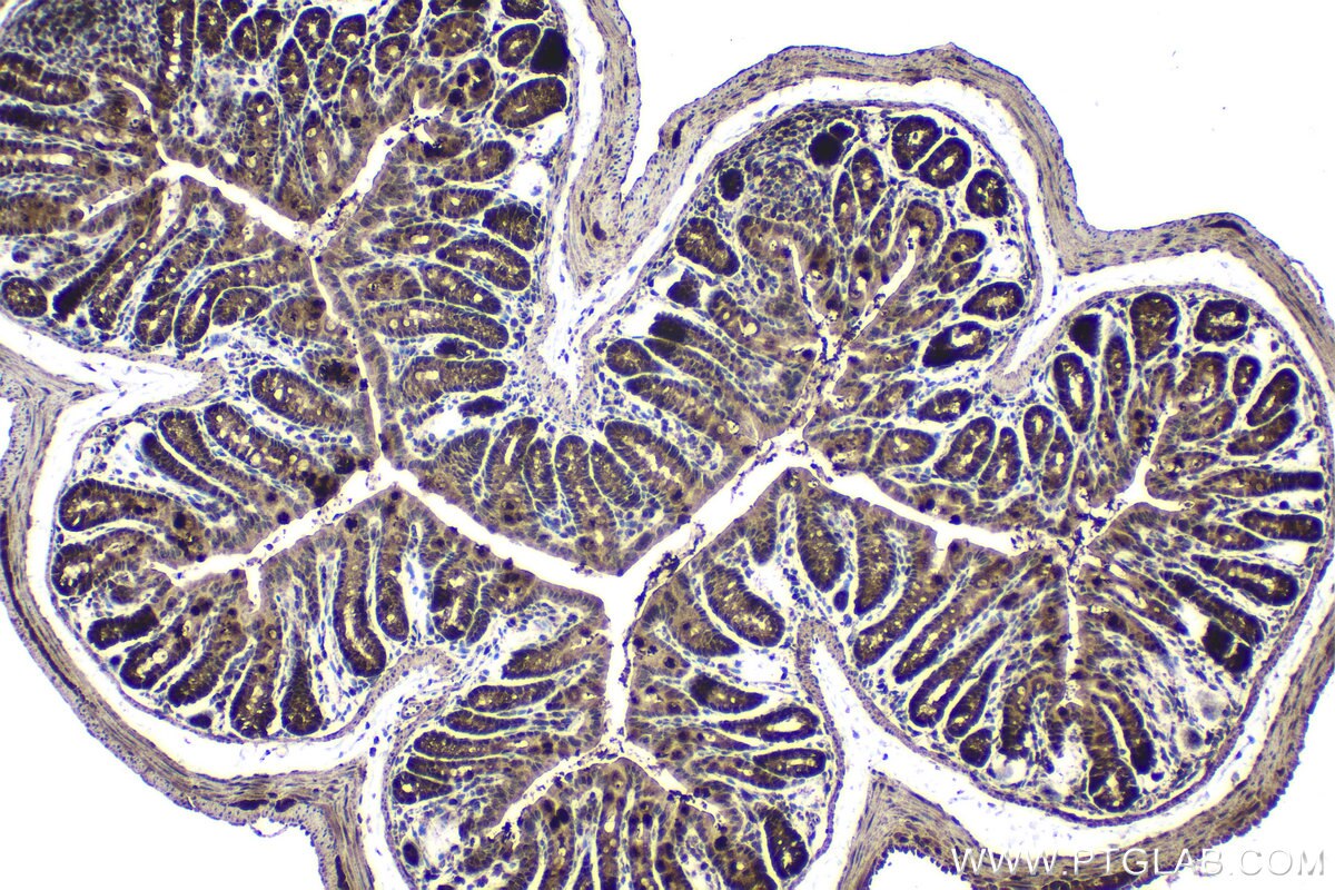 Immunohistochemical analysis of paraffin-embedded mouse colon tissue slide using KHC1524 (PIM1 IHC Kit).