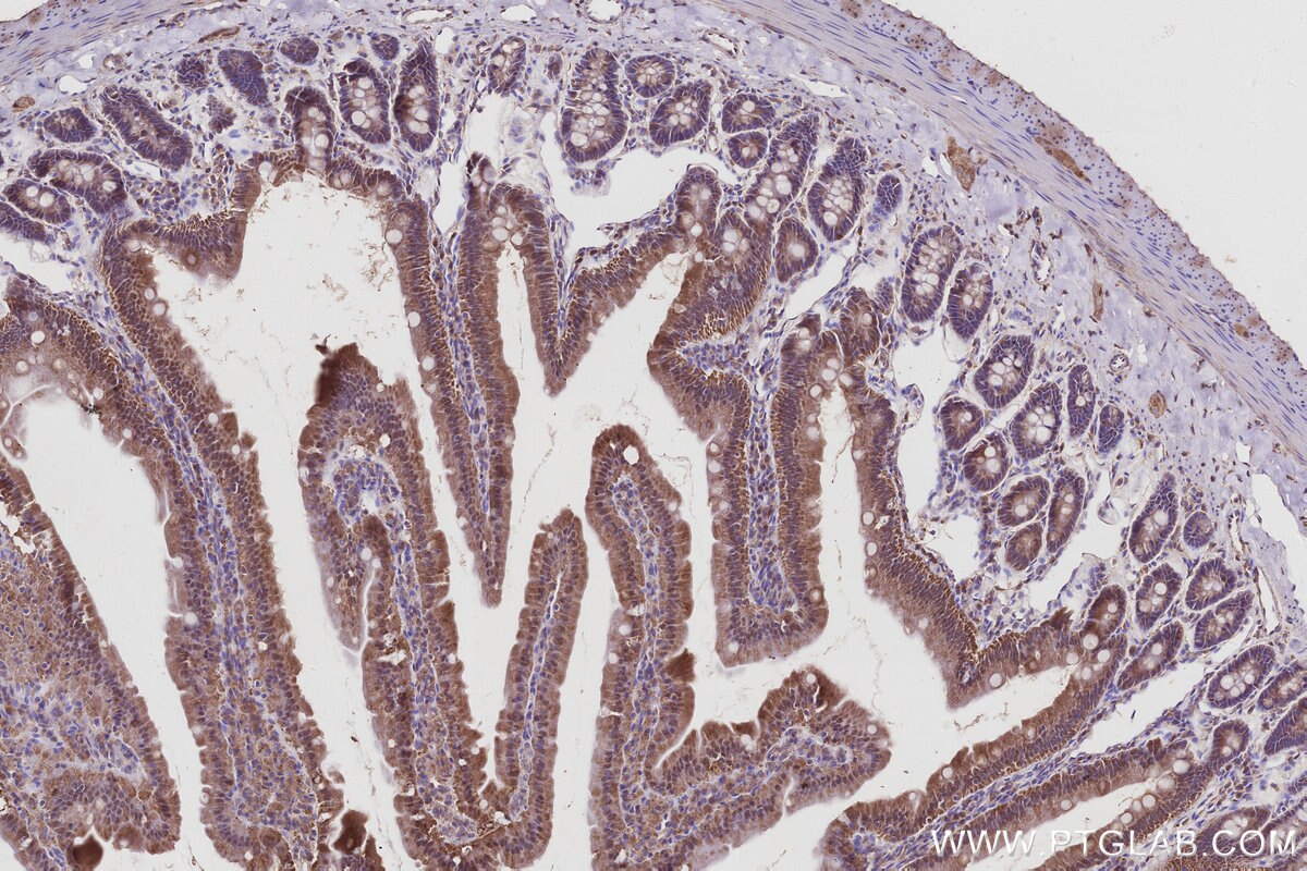 Immunohistochemical analysis of paraffin-embedded rat small intestine tissue slide using KHC2989 (PIM2 IHC Kit).