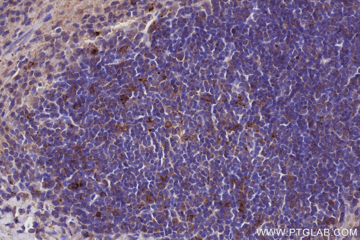 Immunohistochemical analysis of paraffin-embedded mouse spleen tissue slide using KHC2989 (PIM2 IHC Kit).