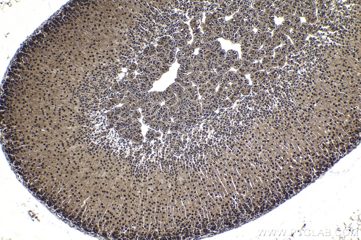 Immunohistochemical analysis of paraffin-embedded mouse adrenal gland tissue slide using KHC1716 (PIN1 IHC Kit).