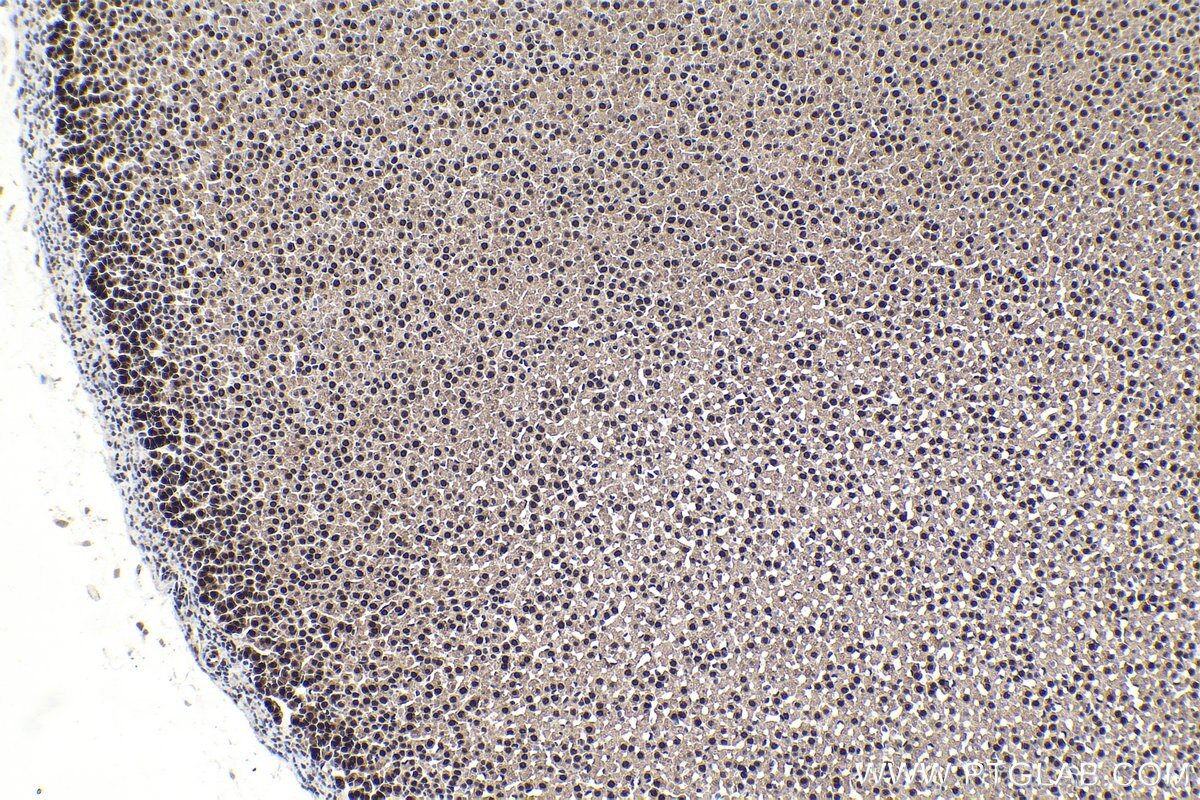 Immunohistochemical analysis of paraffin-embedded rat adrenal gland tissue slide using KHC1716 (PIN1 IHC Kit).