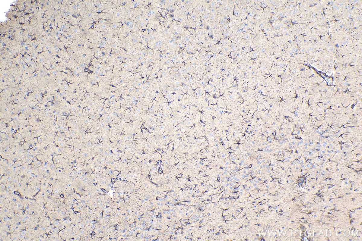 Immunohistochemical analysis of paraffin-embedded rat brain tissue slide using KHC1071 (PINK1 IHC Kit).