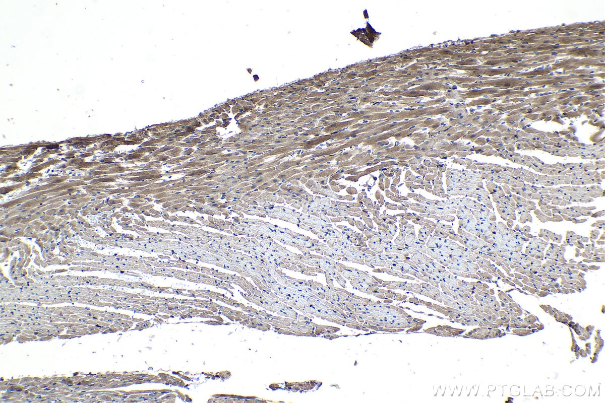 Immunohistochemical analysis of paraffin-embedded mouse heart tissue slide using KHC1071 (PINK1 IHC Kit).