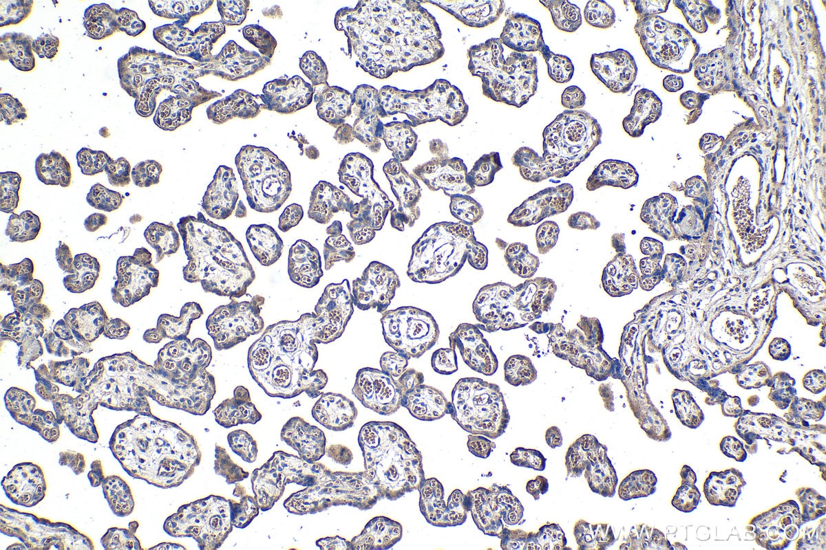 Immunohistochemical analysis of paraffin-embedded human placenta tissue slide using KHC1071 (PINK1 IHC Kit).