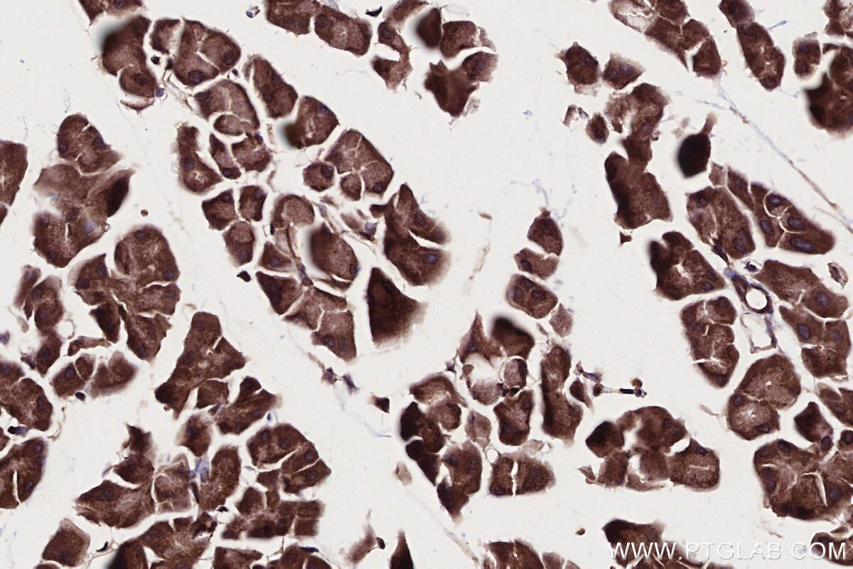 Immunohistochemical analysis of paraffin-embedded mouse pancreas tissue slide using KHC2709 (PIP4K2C IHC Kit).