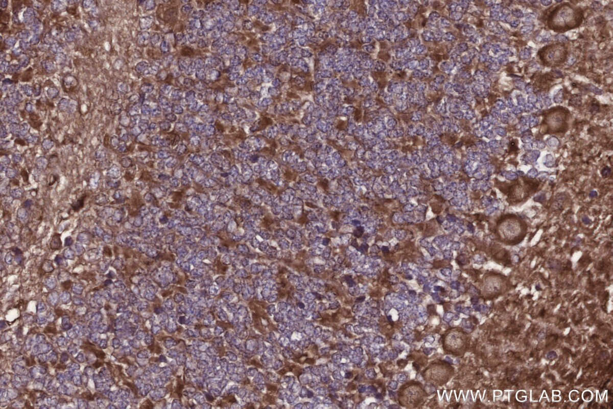 Immunohistochemical analysis of paraffin-embedded mouse cerebellum tissue slide using KHC2709 (PIP4K2C IHC Kit).