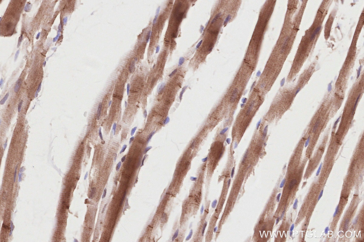 Immunohistochemical analysis of paraffin-embedded rat heart tissue slide using KHC2848 (PIP5K1A IHC Kit).