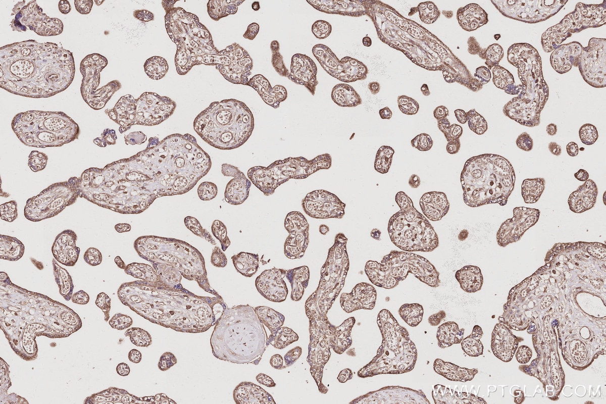 Immunohistochemical analysis of paraffin-embedded human placenta tissue slide using KHC3054 (PIP5K3 IHC Kit). Immunohistochemical analysis of paraffin-embedded human placenta tissue slide using KHC3054 (PIP5K3 IHC Kit).
