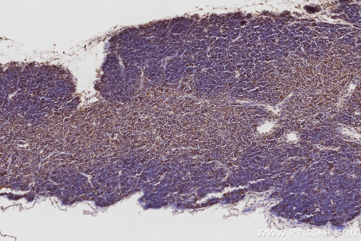 Immunohistochemical analysis of paraffin-embedded mouse thymus tissue slide using KHC3054 (PIP5K3 IHC Kit). Immunohistochemical analysis of paraffin-embedded mouse thymus tissue slide using KHC3054 (PIP5K3 IHC Kit).