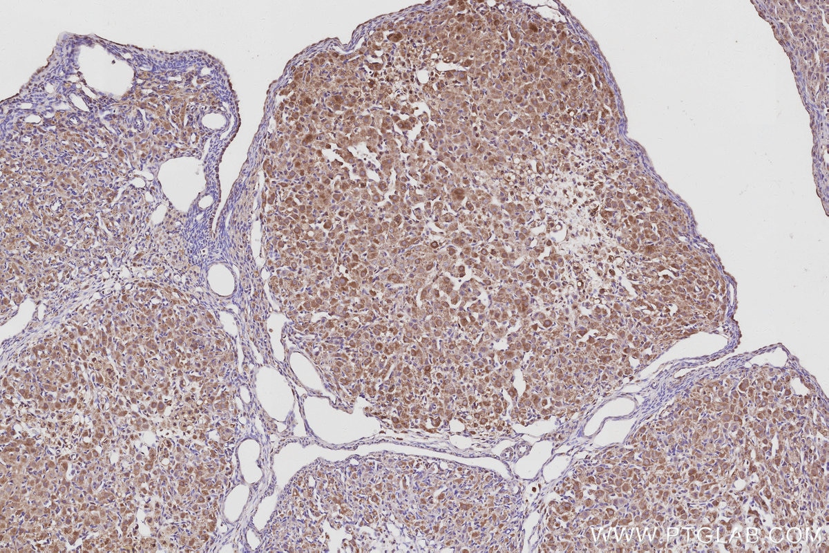 Immunohistochemical analysis of paraffin-embedded rat ovary tissue slide using KHC3054 (PIP5K3 IHC Kit). Immunohistochemical analysis of paraffin-embedded rat ovary tissue slide using KHC3054 (PIP5K3 IHC Kit).