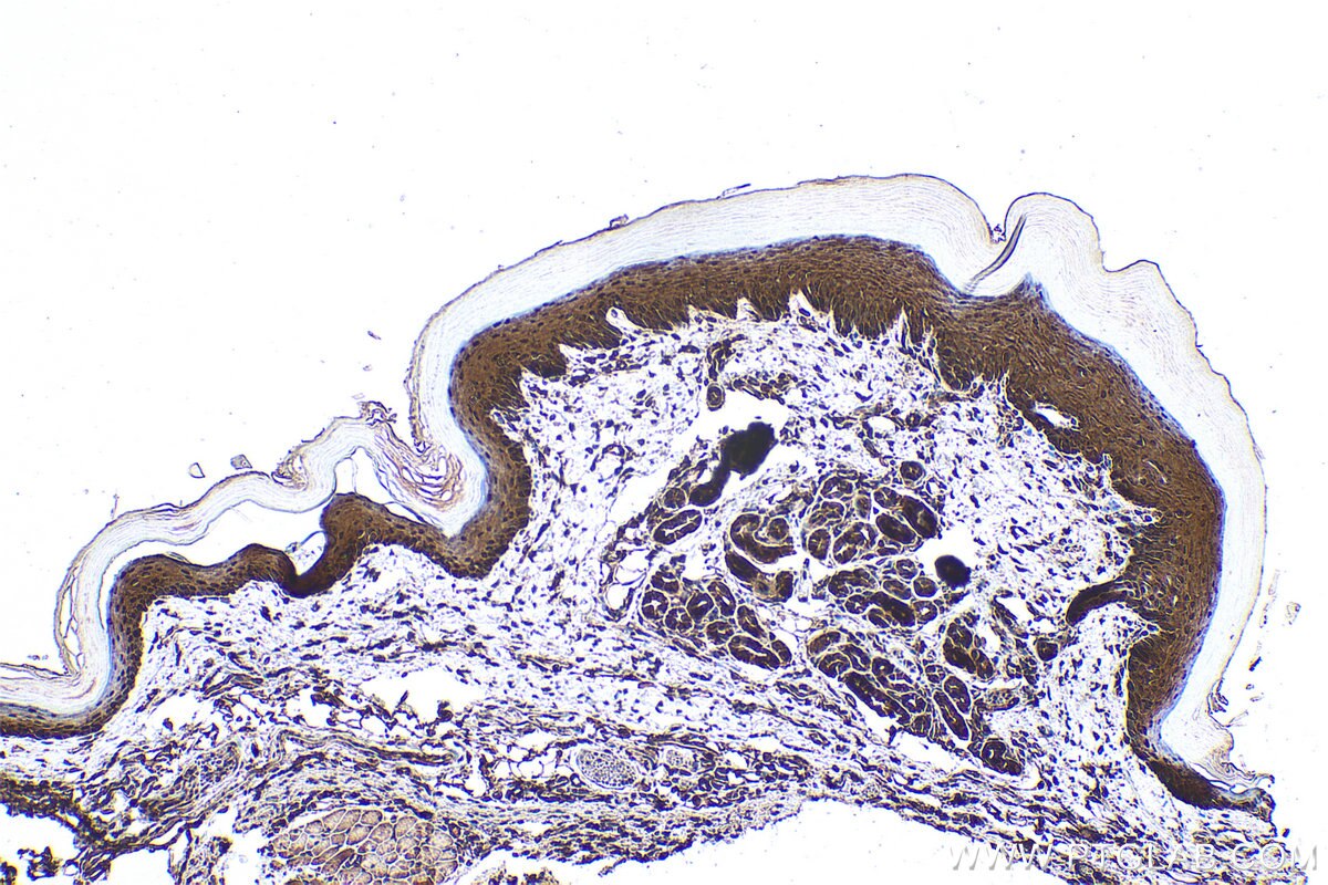 Immunohistochemical analysis of paraffin-embedded mouse skin tissue slide using KHC0984 (PITPNA IHC Kit).