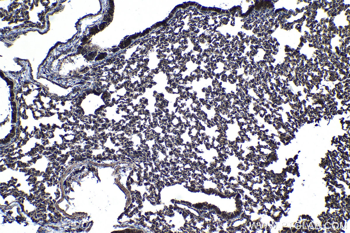 Immunohistochemical analysis of paraffin-embedded mouse lung tissue slide using KHC0984 (PITPNA IHC Kit).