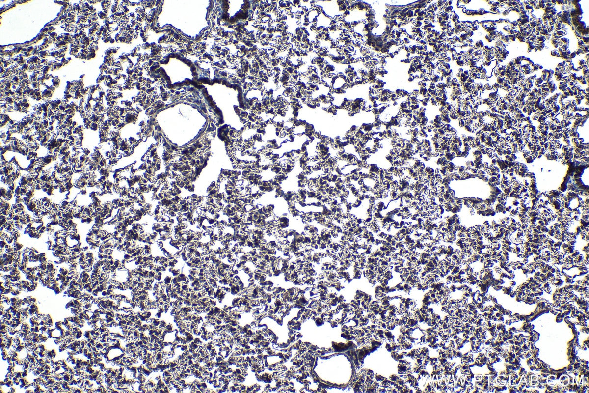 Immunohistochemical analysis of paraffin-embedded rat lung tissue slide using KHC0984 (PITPNA IHC Kit).