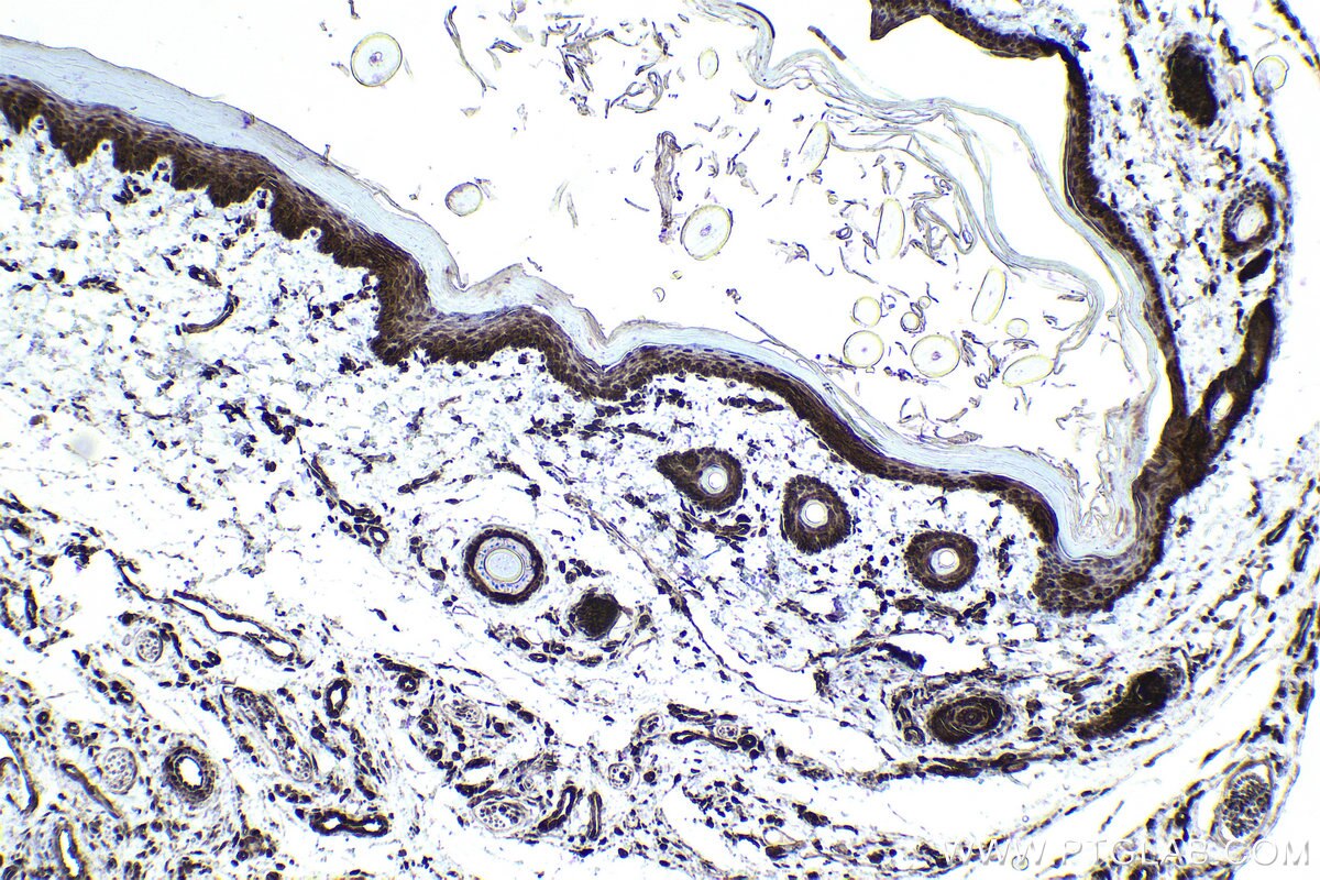 Immunohistochemical analysis of paraffin-embedded rat skin tissue slide using KHC0984 (PITPNA IHC Kit).