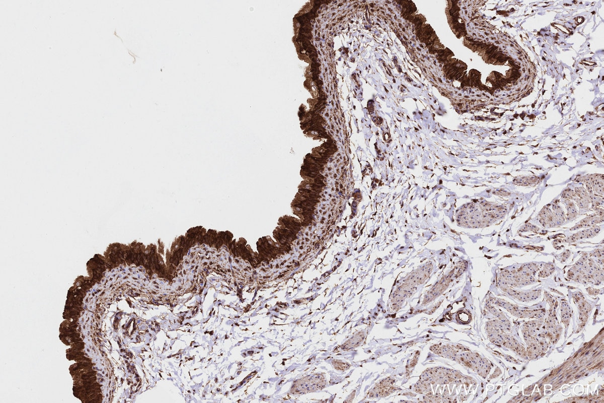 Immunohistochemical analysis of paraffin-embedded rat bladder tissue slide using KHC3215 (PITPNB IHC Kit). Immunohistochemical analysis of paraffin-embedded rat bladder tissue slide using KHC3215 (PITPNB IHC Kit).