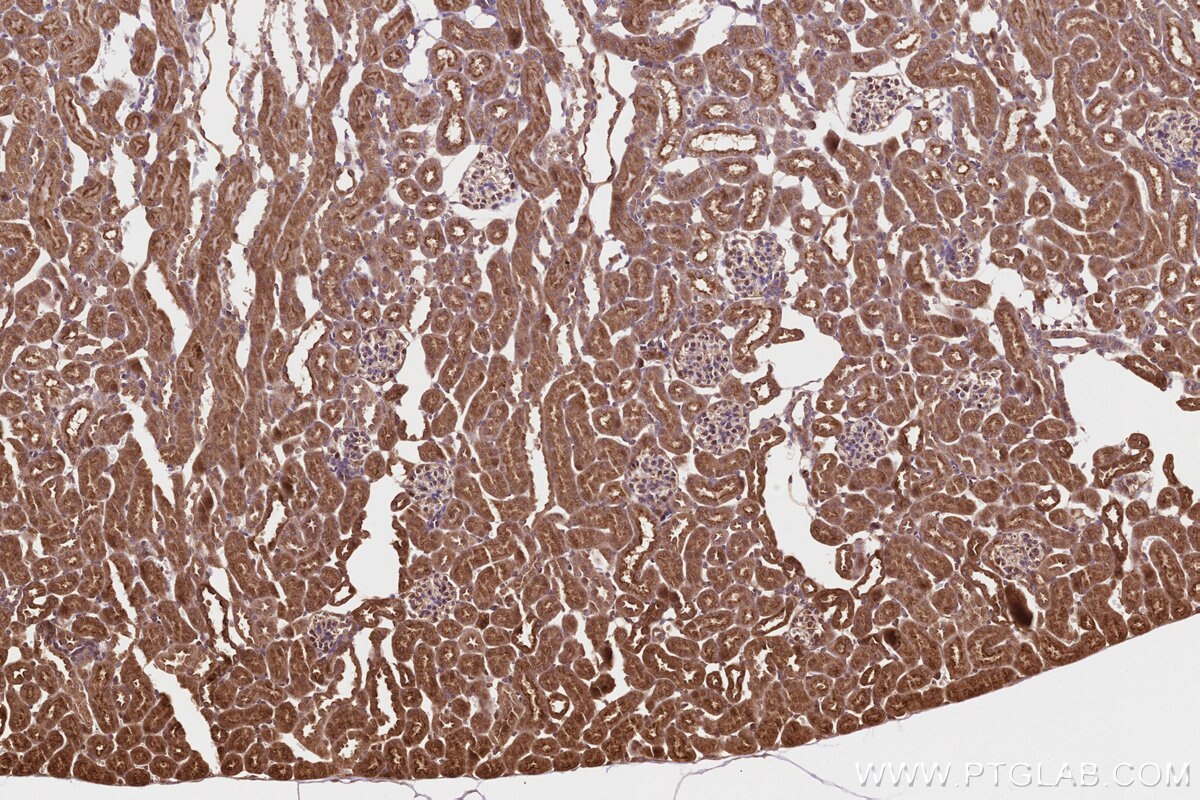Immunohistochemical analysis of paraffin-embedded mouse kidney tissue slide using KHC3215 (PITPNB IHC Kit). Immunohistochemical analysis of paraffin-embedded mouse kidney tissue slide using KHC3215 (PITPNB IHC Kit).
