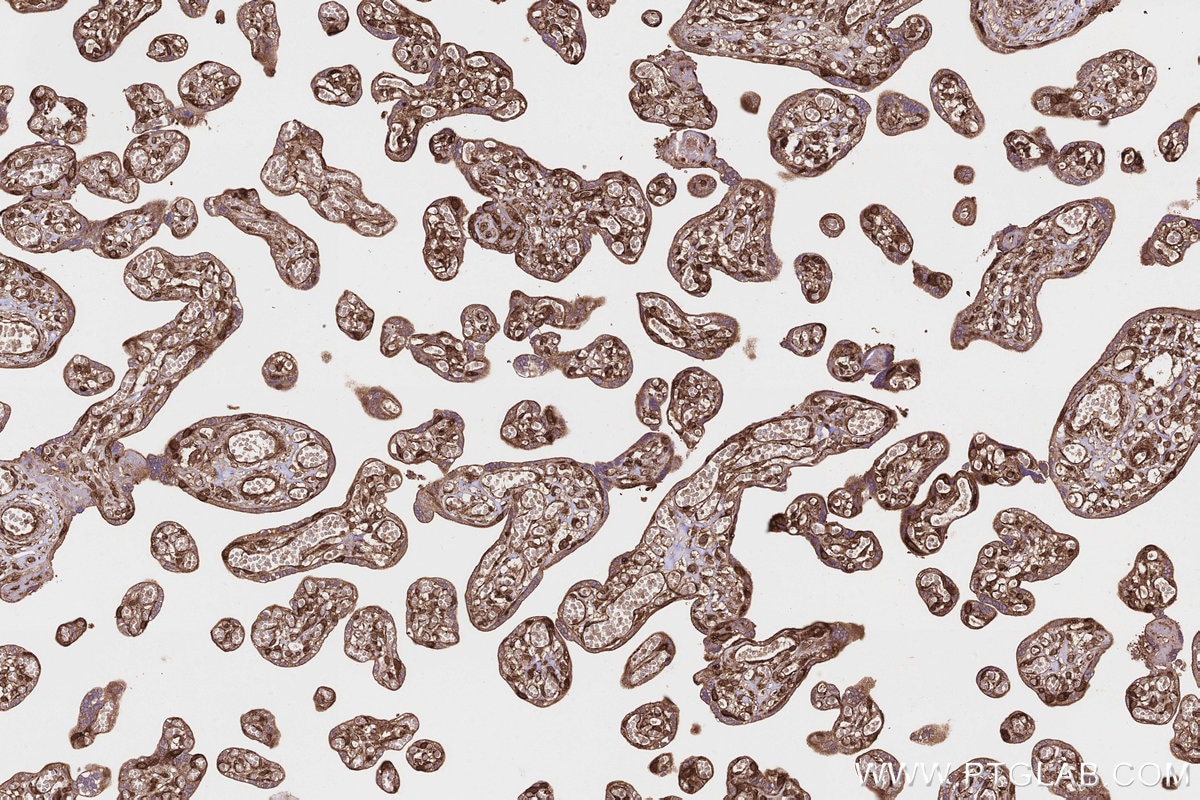 Immunohistochemical analysis of paraffin-embedded human placenta tissue slide using KHC3215 (PITPNB IHC Kit). Immunohistochemical analysis of paraffin-embedded human placenta tissue slide using KHC3215 (PITPNB IHC Kit).