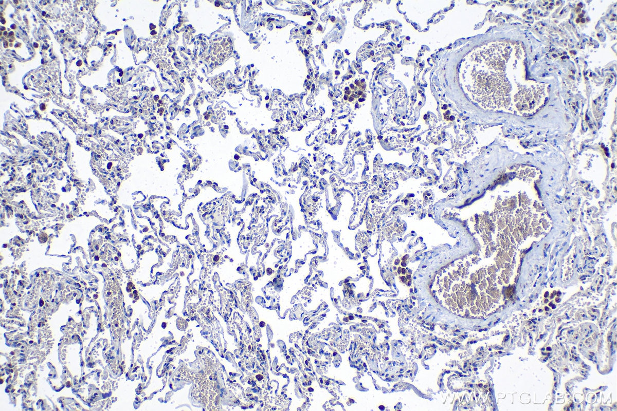 Immunohistochemical analysis of paraffin-embedded human lung tissue slide using KHC1370 (PITRM1 IHC Kit).