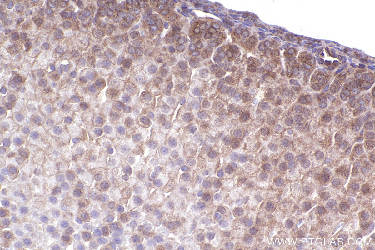 Immunohistochemical analysis of paraffin-embedded mouse adrenal gland tissue slide using KHC2376 (PKD1 IHC Kit).