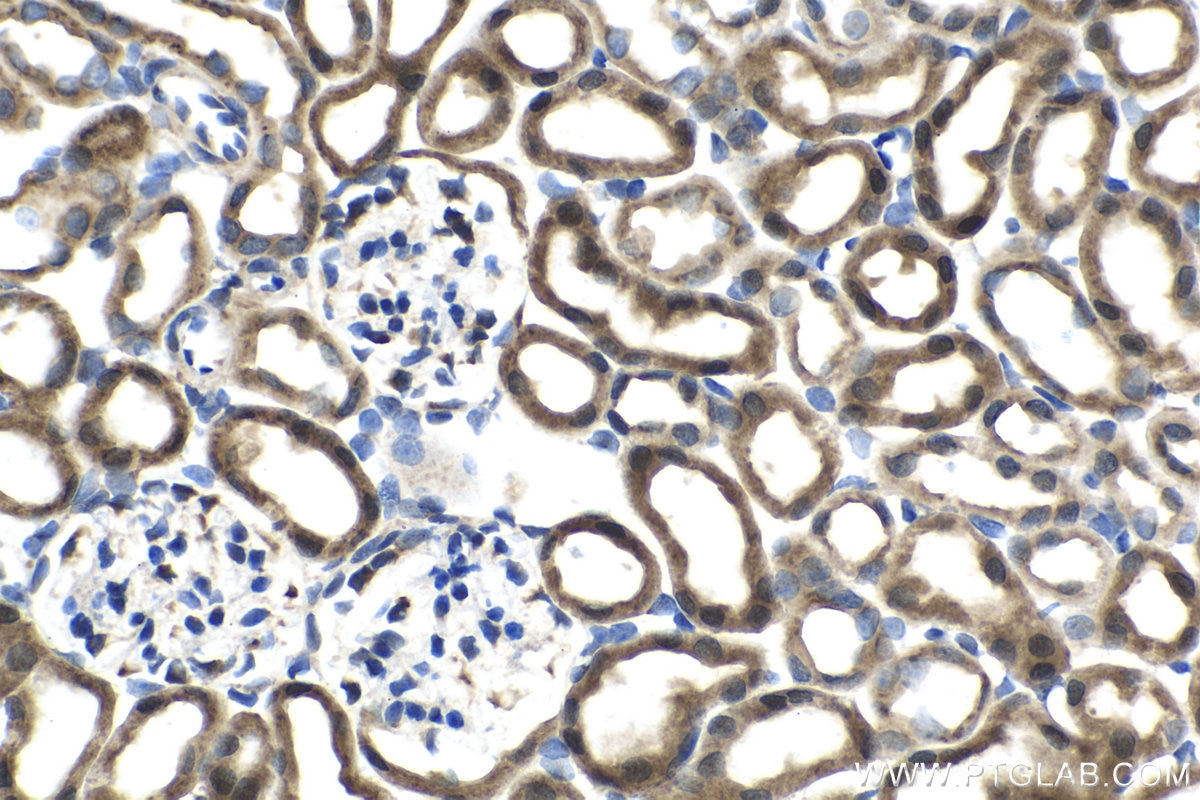 Immunohistochemical analysis of paraffin-embedded mouse kidney tissue slide using KHC1515 (PKHD1 IHC Kit).